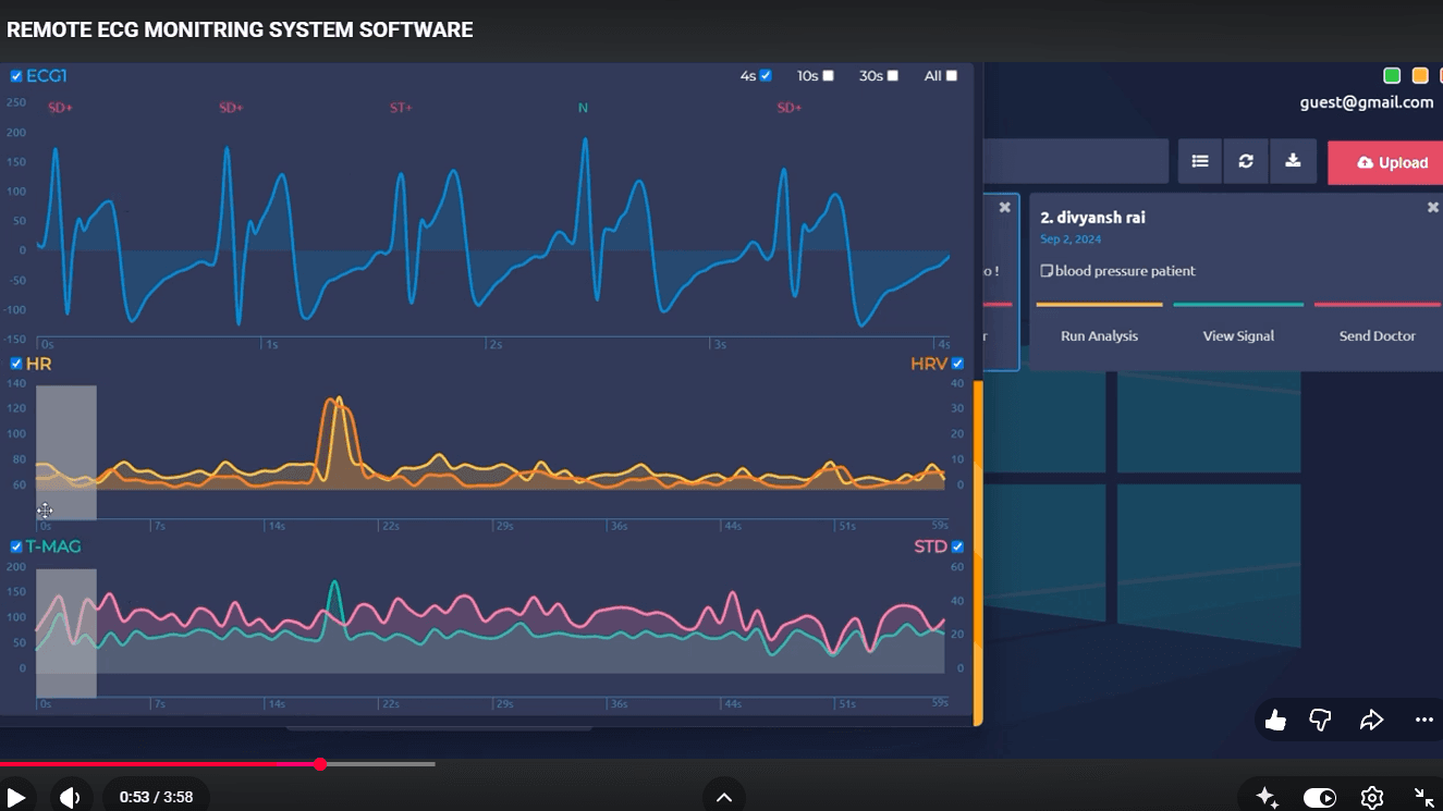 Remote ECG Monitoring screenshot 2